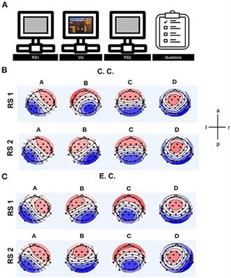 EEG-Microstates Reflect Auditory Distraction After Attentive Audiovisual Perception Recruitment of Cognitive Control Networks